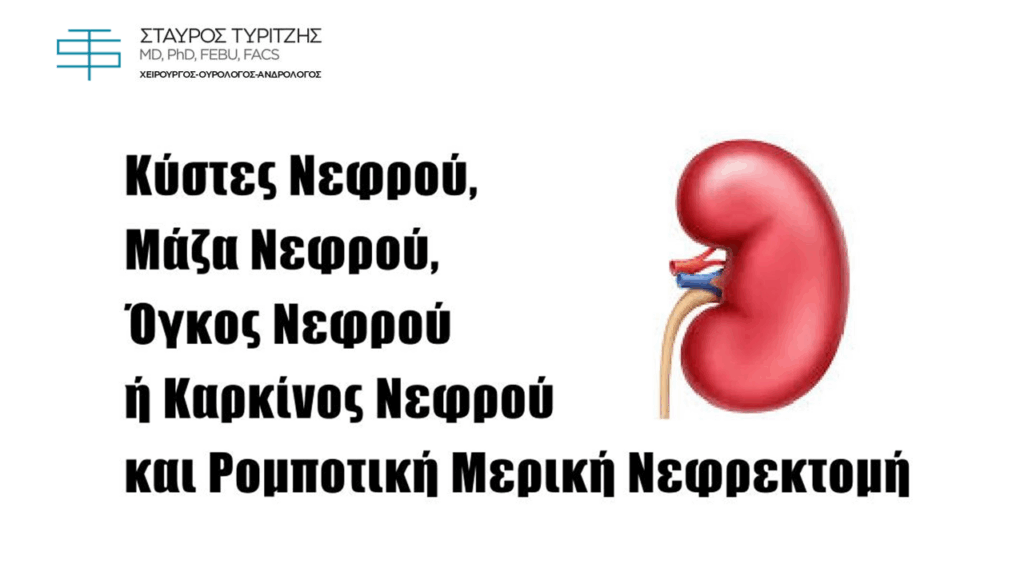 Κύστες Νεφρού, Μάζα Νεφρού, Όγκος Νεφρού ή Καρκίνος Νεφρού και Ρομποτική Μερική Νεφρεκτομή