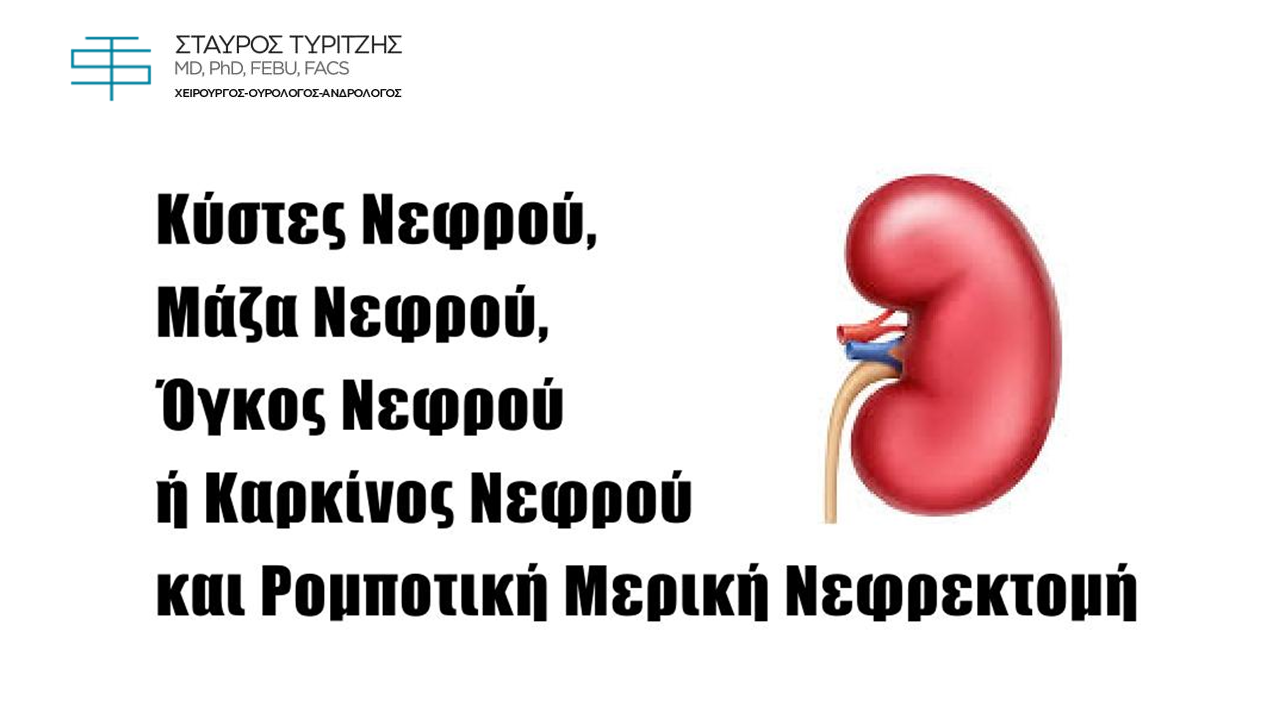 Κύστες Νεφρού, Μάζα Νεφρού, Όγκος Νεφρού ή Καρκίνος Νεφρού και Ρομποτική Μερική Νεφρεκτομή