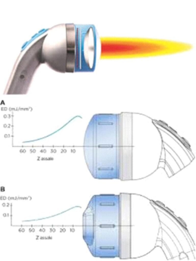 Dornier Aries 2 SmartFocus